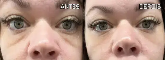 Antes e depois apresentado na página Remove Japan