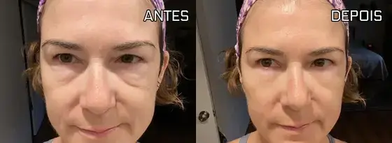 Antes e depois apresentado na página Remove Japan