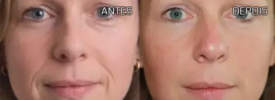 Antes e depois apresentado na página Remove Japan